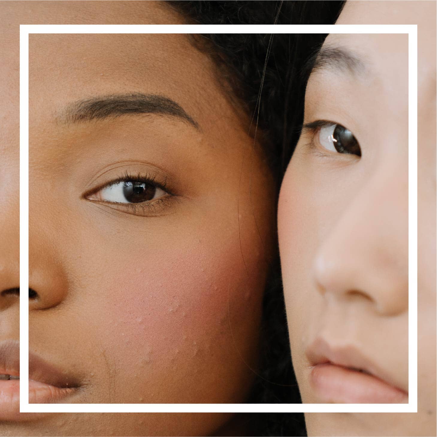 Everything You Need To Know About Why Winter Acne Is So Stubborn