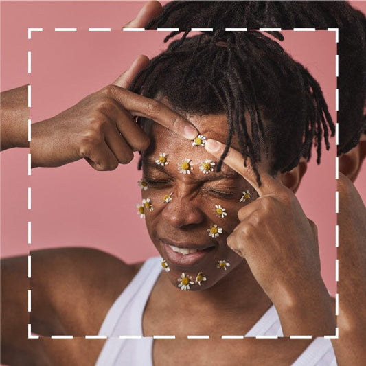 Here's How to Zap Away Those Annoying Forehead Bumps