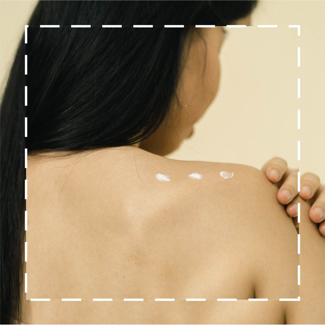 Your Guide to Dealing With Body Breakouts (And How They Differ From Facial Acne)