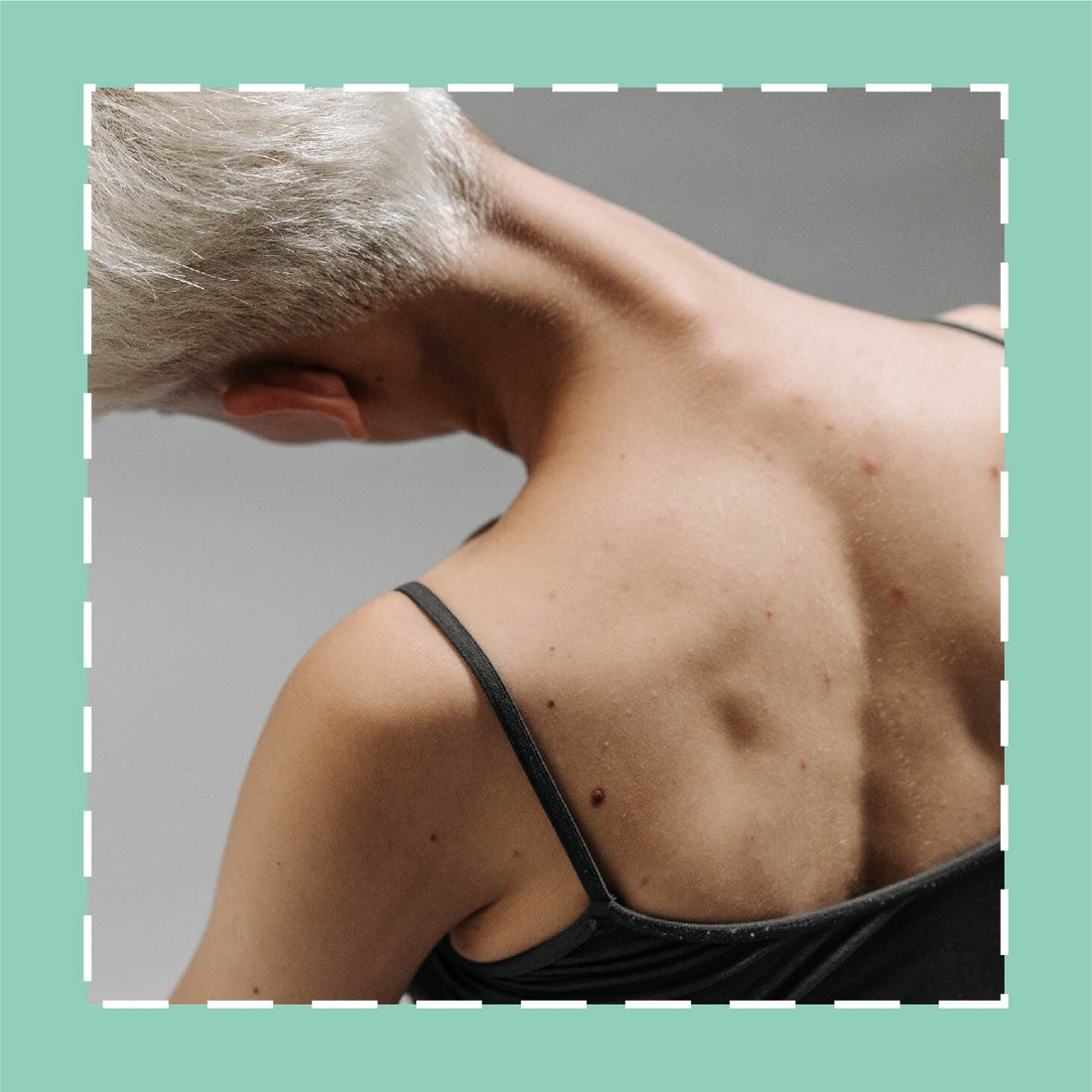 Here’s How Body Hyperpigmentation Differs From Facial Hyperpigmentation