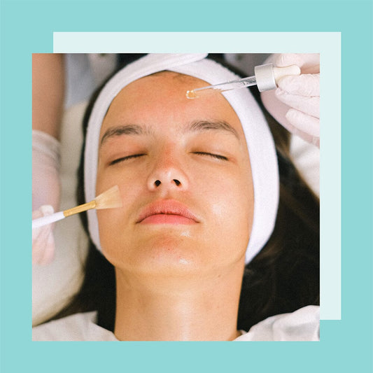 How to Take Care of Your Skin After a Chemical Peel