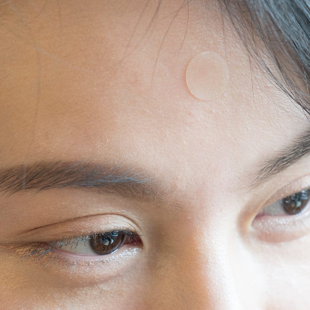 6 K-beauty Dupes for Popular Western Acne Spot Treatments