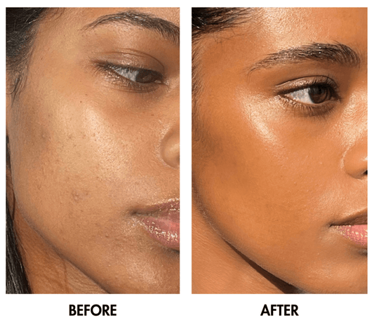 My Six-Week Journey With Red Light Therapy