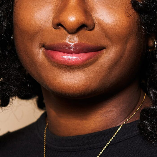 How To Treat And Prevent Cold Sores