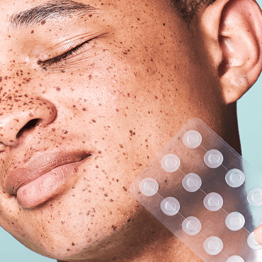 A Major Announcement: The Klog Skin Care is Here!