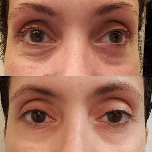 The Peptide-Packed Fermentation Eye Cream That Made One Woman’s Eyes Look More Youthful and Less Tired in Two Weeks