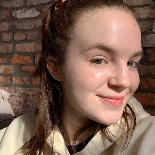 How Eating Clean For One Week Improved My Acne-Prone Skin