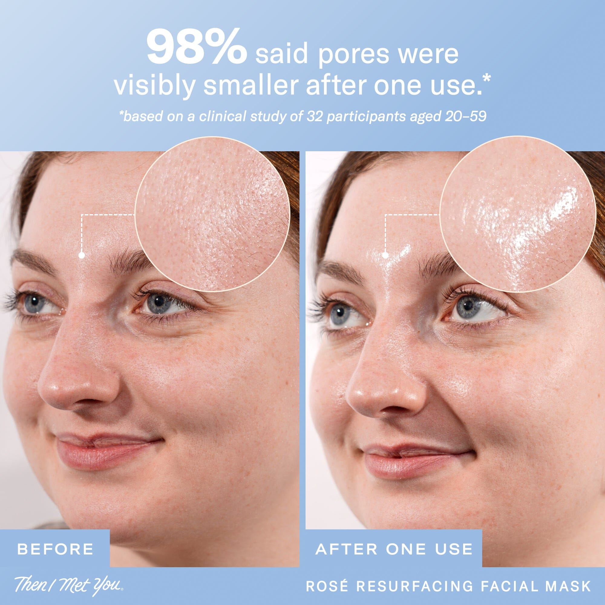 Then I Met You Rosé Resurfacing Facial Mask | Soko Glam