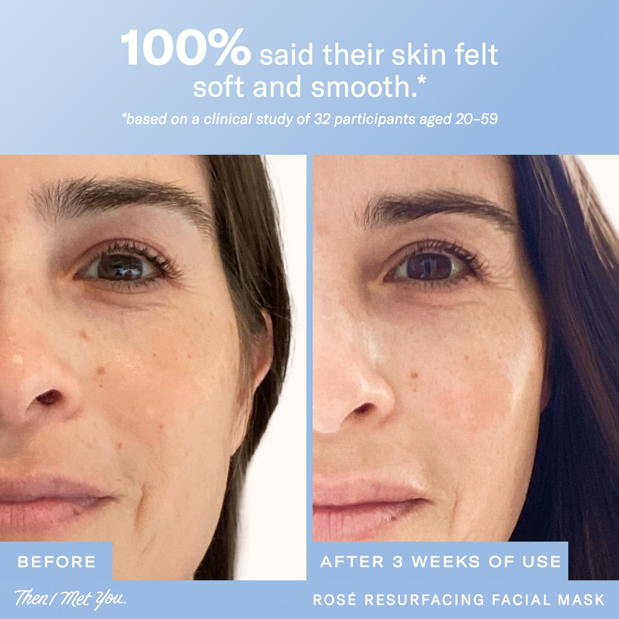 Then I Met You Rosé Resurfacing Facial Mask | Soko Glam