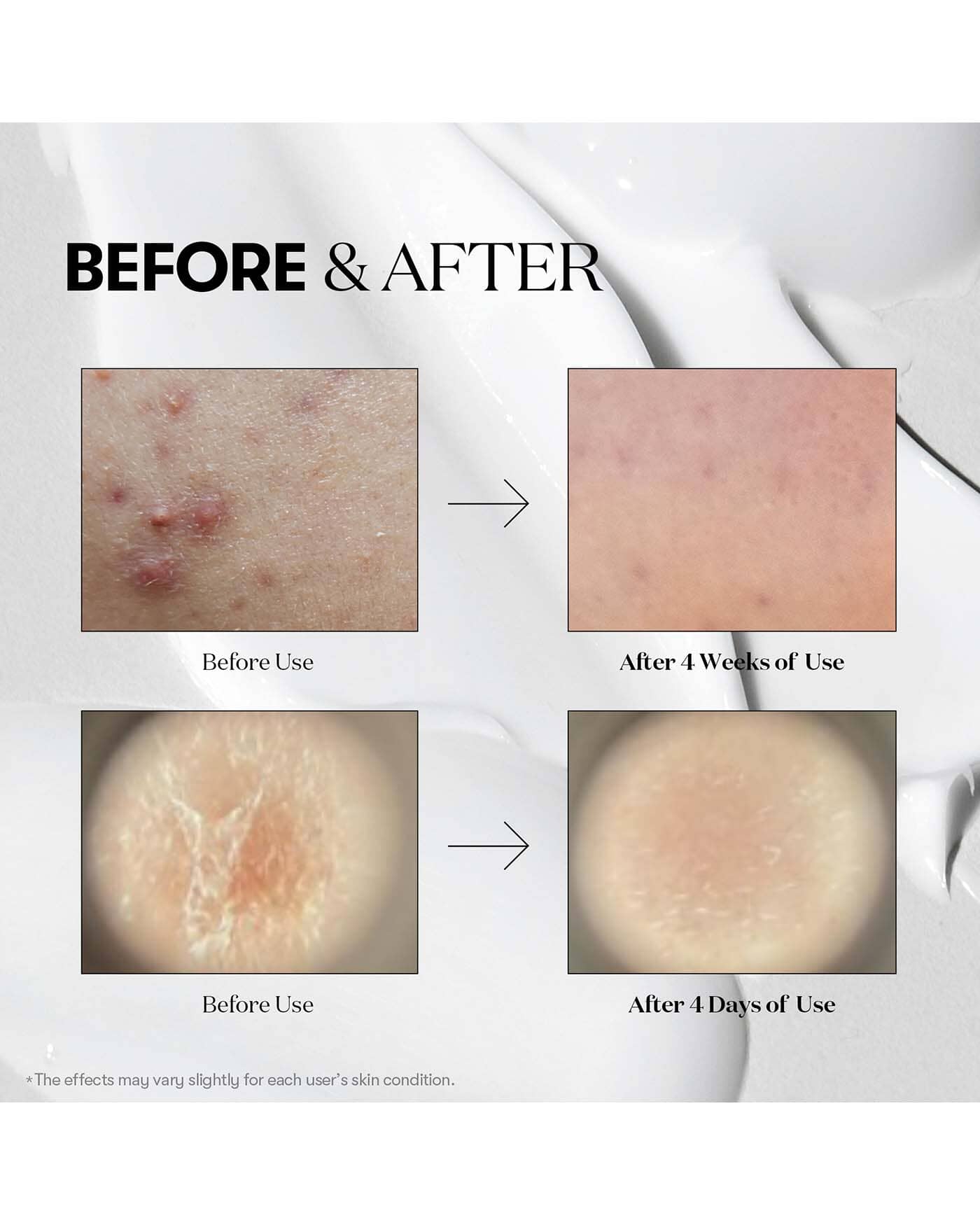 VT Reedle Shot 100 Treatment VT COSMETICS 