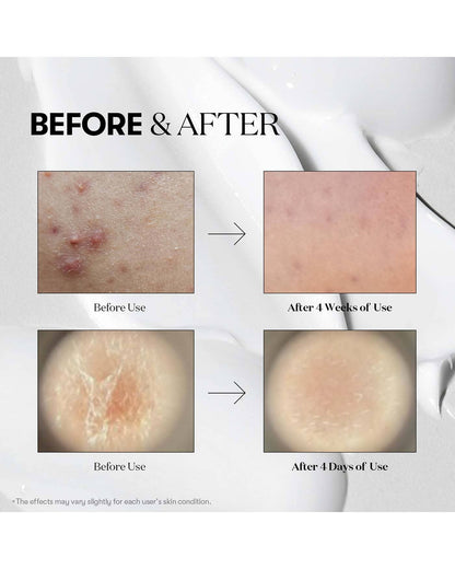 VT Reedle Shot 100 Treatment VT COSMETICS 