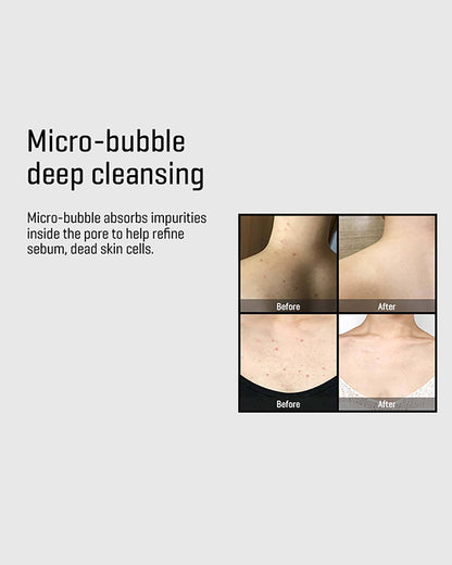 AHA-BHA-PHA 30 Days Miracle Acne Clear Body Cleanser Body SOME BY MI 