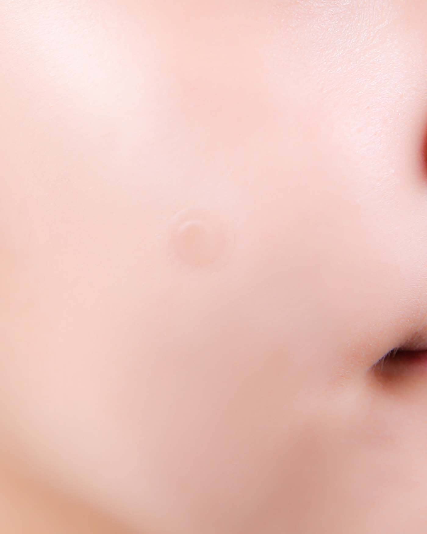 A-Clear Soothing Clear Spot Patch Spot NEOGEN 