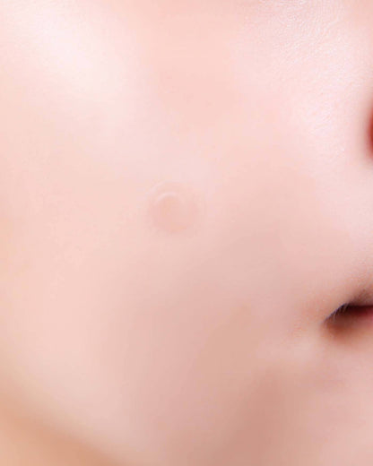 A-Clear Soothing Clear Spot Patch Spot NEOGEN 