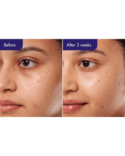 IOPE PDRN Duo Skincare Set IOPE 