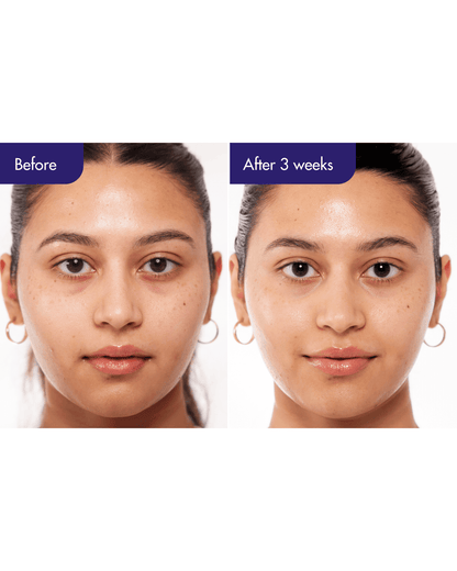 IOPE PDRN Duo Skincare Set IOPE 