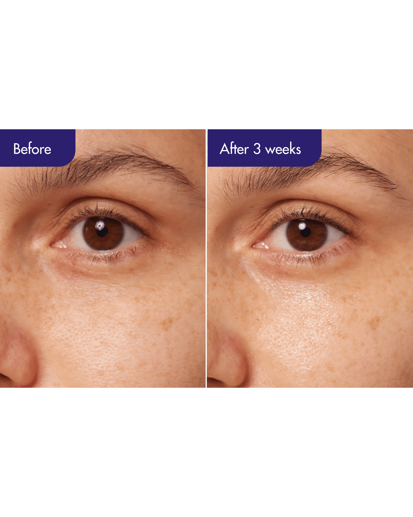 IOPE Retinol Expert 0.1% | Soko Glam IOPE Retinol Expert 0.1% | Soko Glam