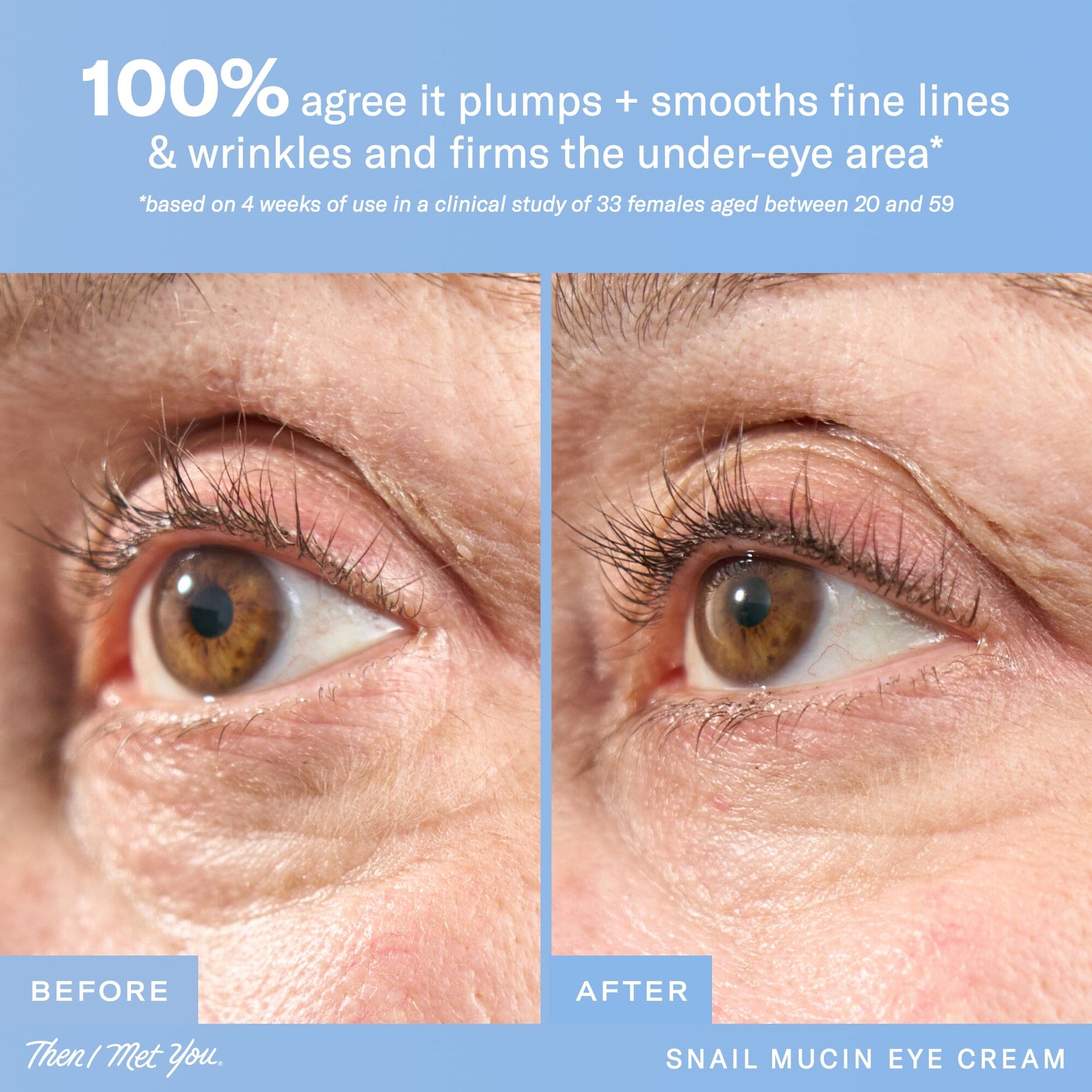 Snail Mucin Eye Cream