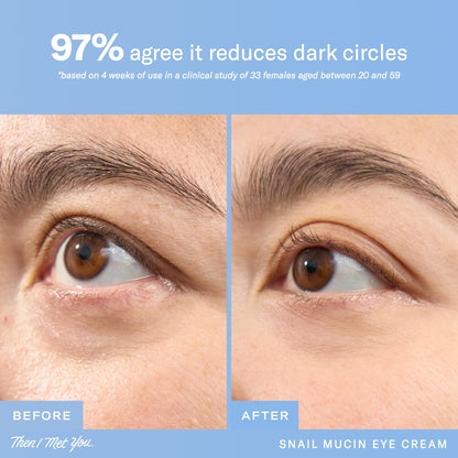 Snail Mucin Eye Cream Soko Glam 