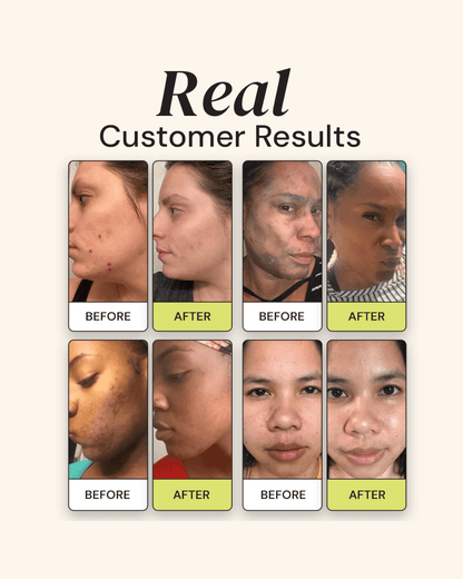 Clarifying Brightening Cleanser Water Cleanser Gleamin 