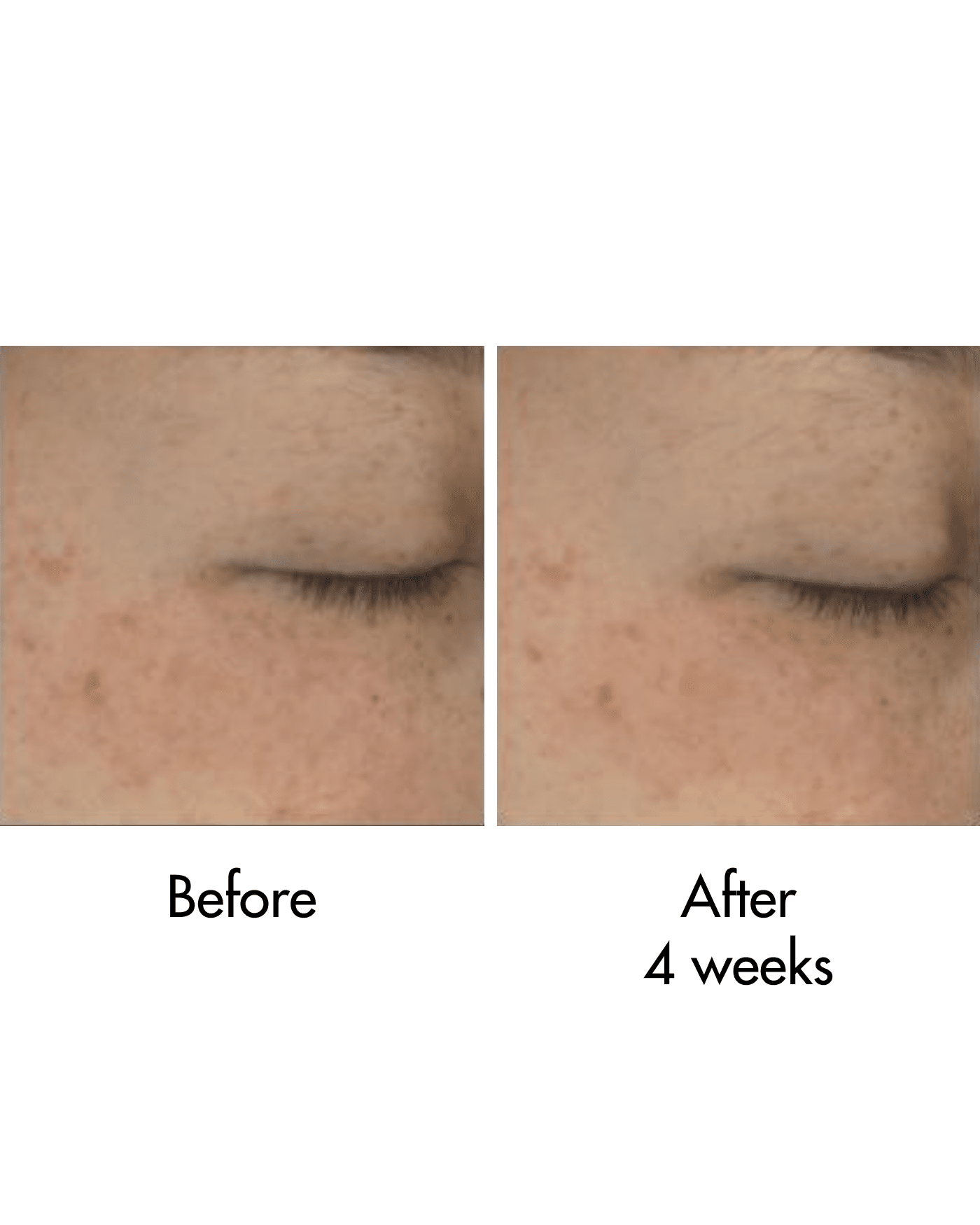 Black Rice Bakuchiol Eye Cream