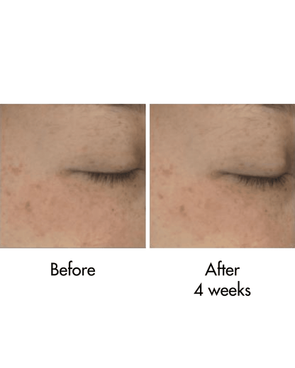 Black Rice Bakuchiol Eye Cream Eye cream Haruharu Wonder 