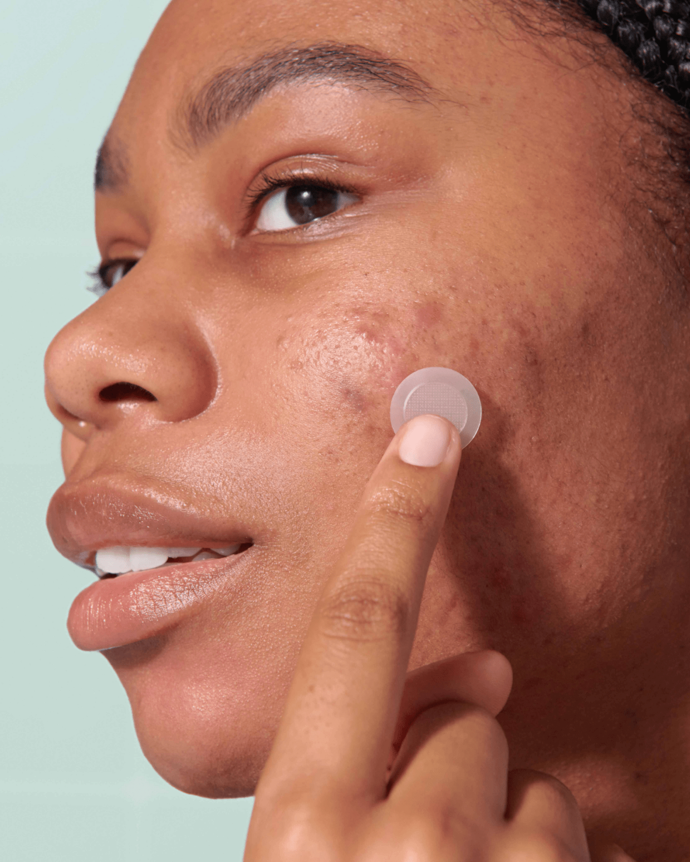 Might Patch - Micropoint for Blemishes Treatment/Balm Hero Cosmetics 