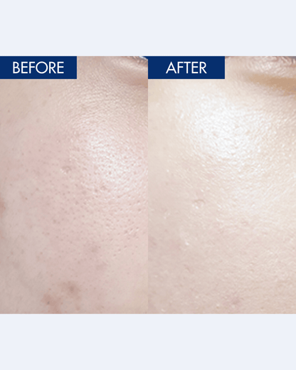 YULMU Brightening Spot Cream Facial Moisturizer INWARD 