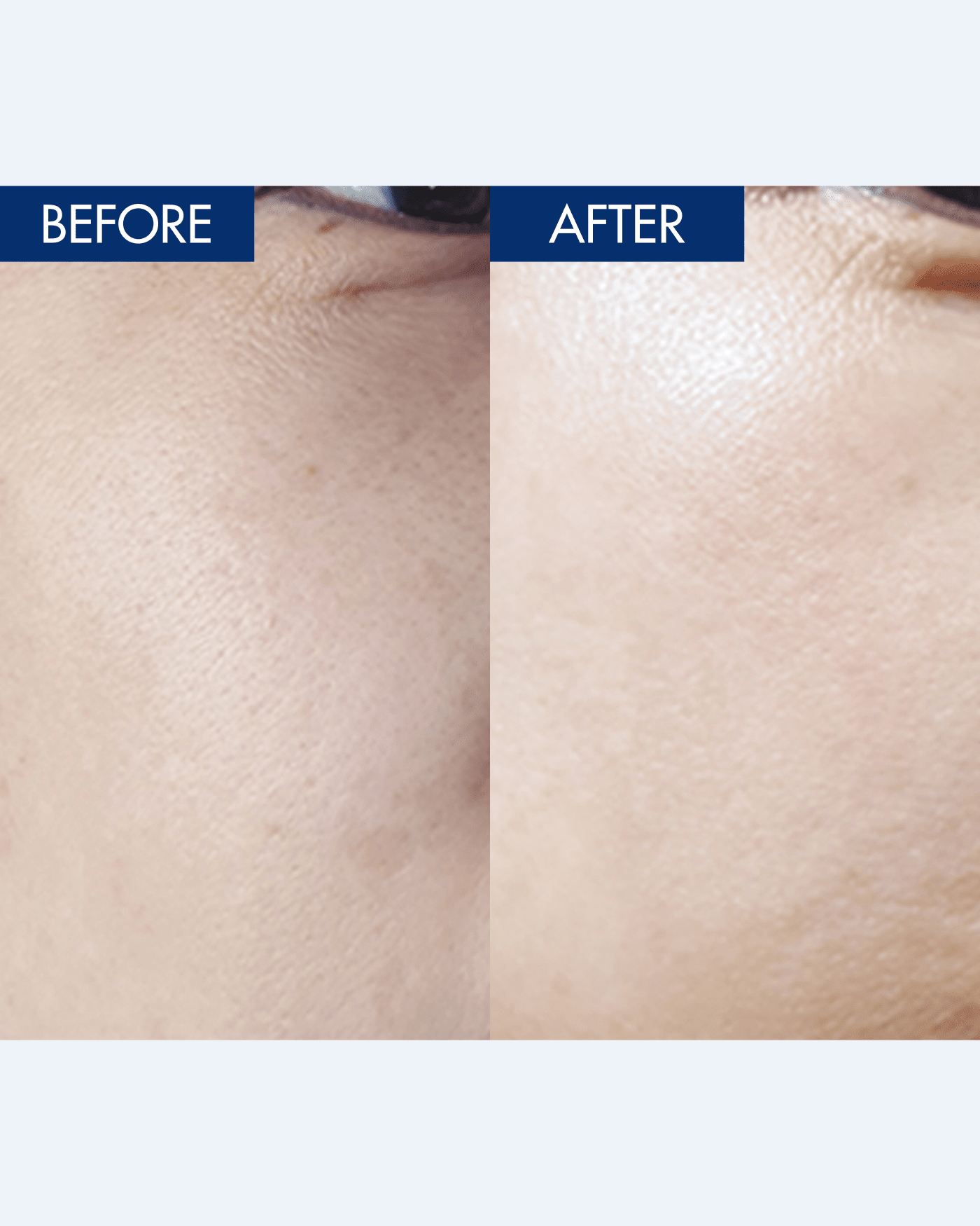 YULMU  Brightening Spot Cream