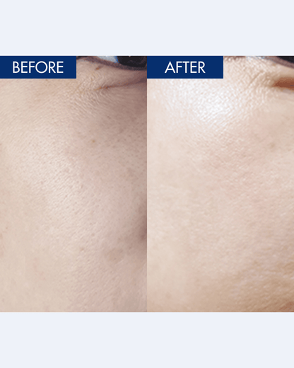 YULMU Brightening Spot Cream Facial Moisturizer INWARD 