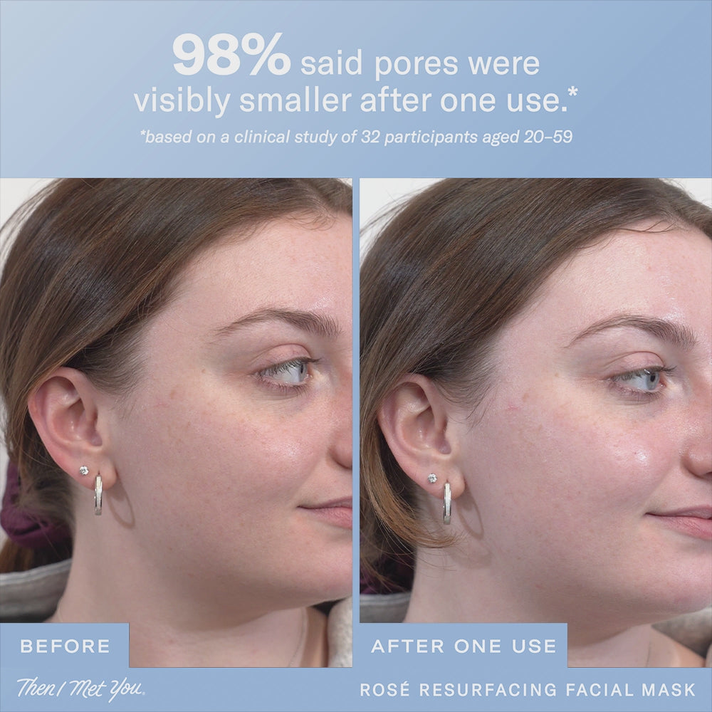 Then I Met You Rosé Resurfacing Facial Mask | Soko Glam