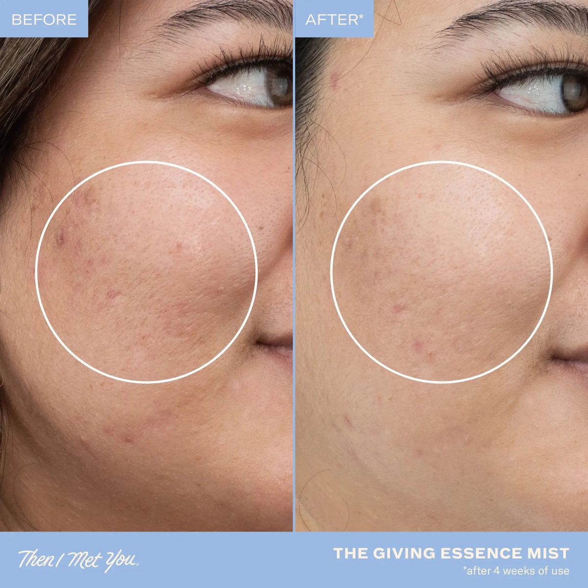 The Giving Essence Mist Facial Mist Then I Met You 