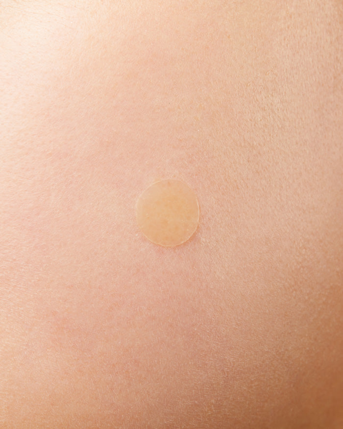Acne Pimple Master Patch Spot COSRX 