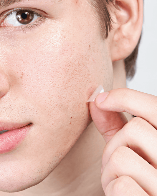 Micropoint for Blemishes Spot Hero Cosmetics 