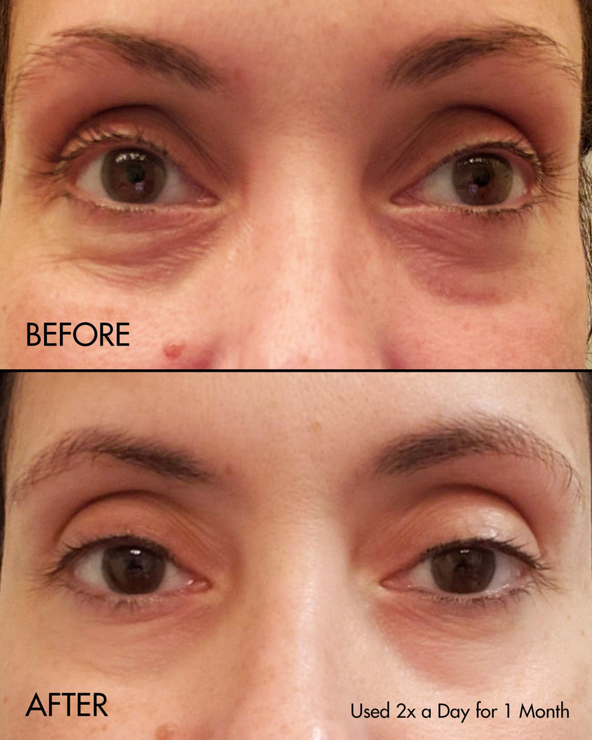 Fermentation Peptine Eye Care Cream - Before and After photo