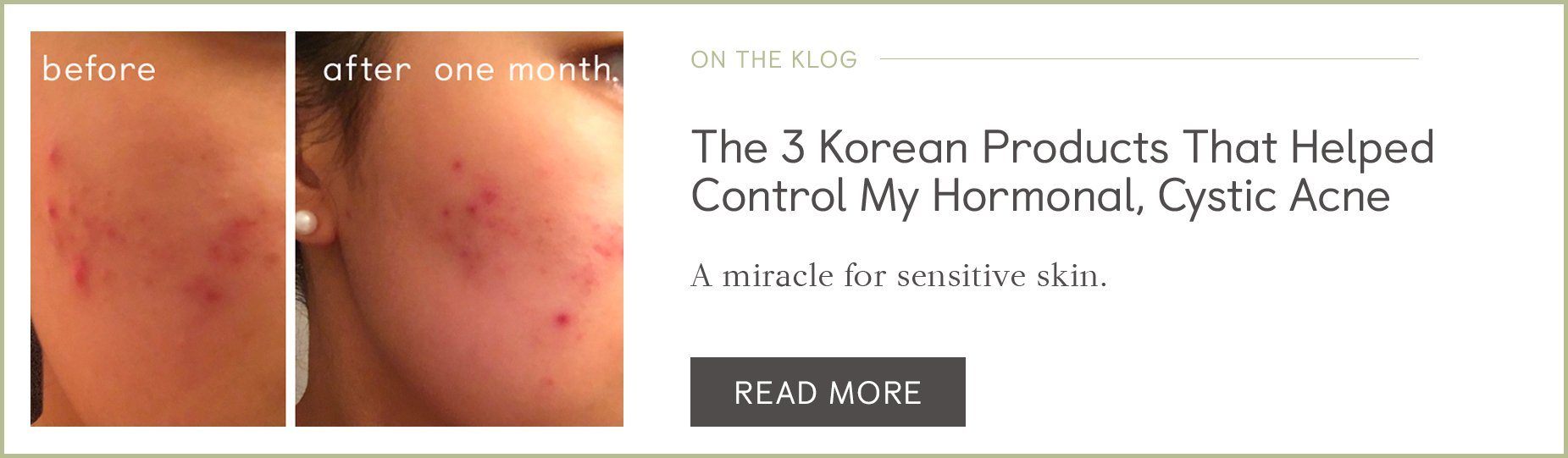learn more about the 3 products that helped control my acne