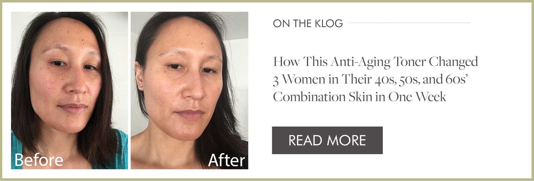 How anti aging toner changed womens combination skin in one week